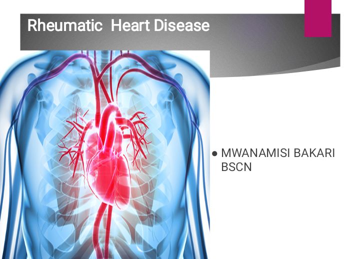 No preview available